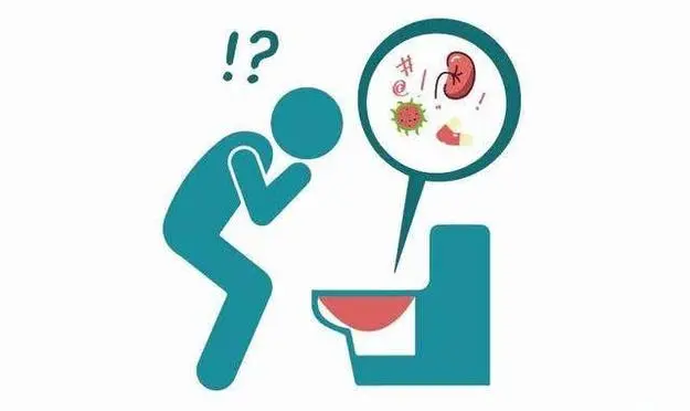 佛山碎石，佛山碎石医院，佛山泌尿碎石