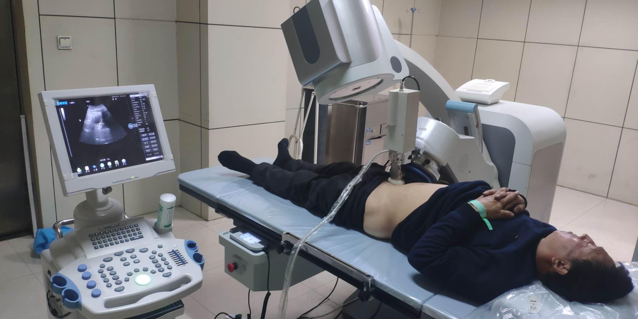 佛山碎石,佛山泌尿碎石,佛山碎石医院