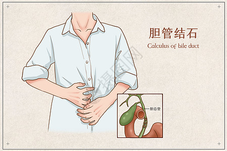 中山肾结石,中山肾结石医院,中山专业治疗肾结石比较好的医院