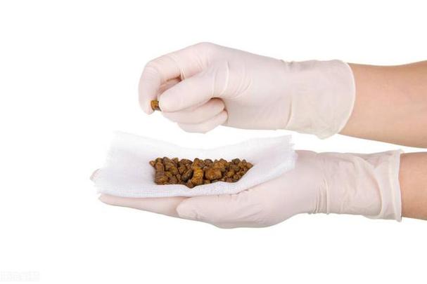 佛山结石医院,佛山治结石,佛山有没有治疗结石的医院