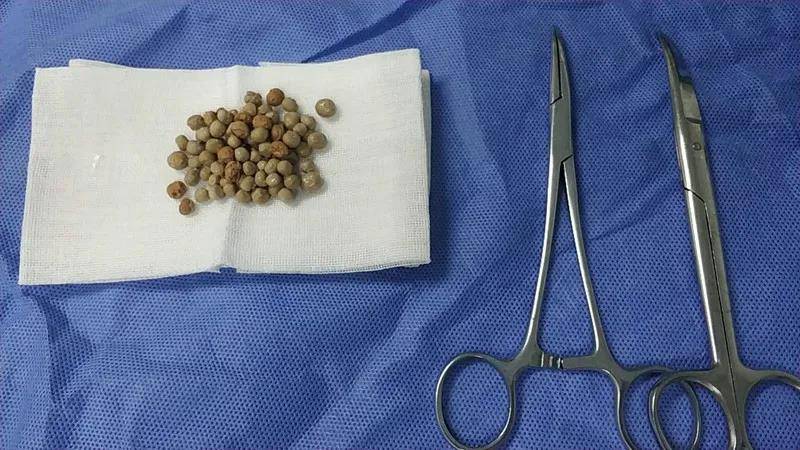 佛山结石专科排名,佛山结石医院排名,佛山结石专科医院排名